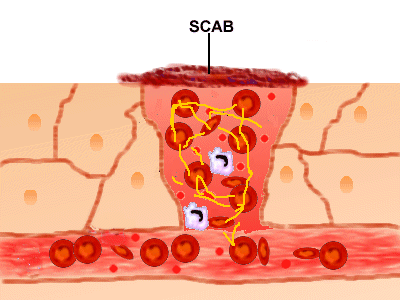 scab forms